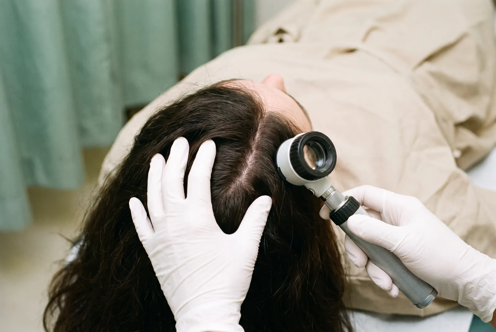 Manos enguantadas separan el cabello para examinar de cerca el cuero cabelludo con un dermatoscopio