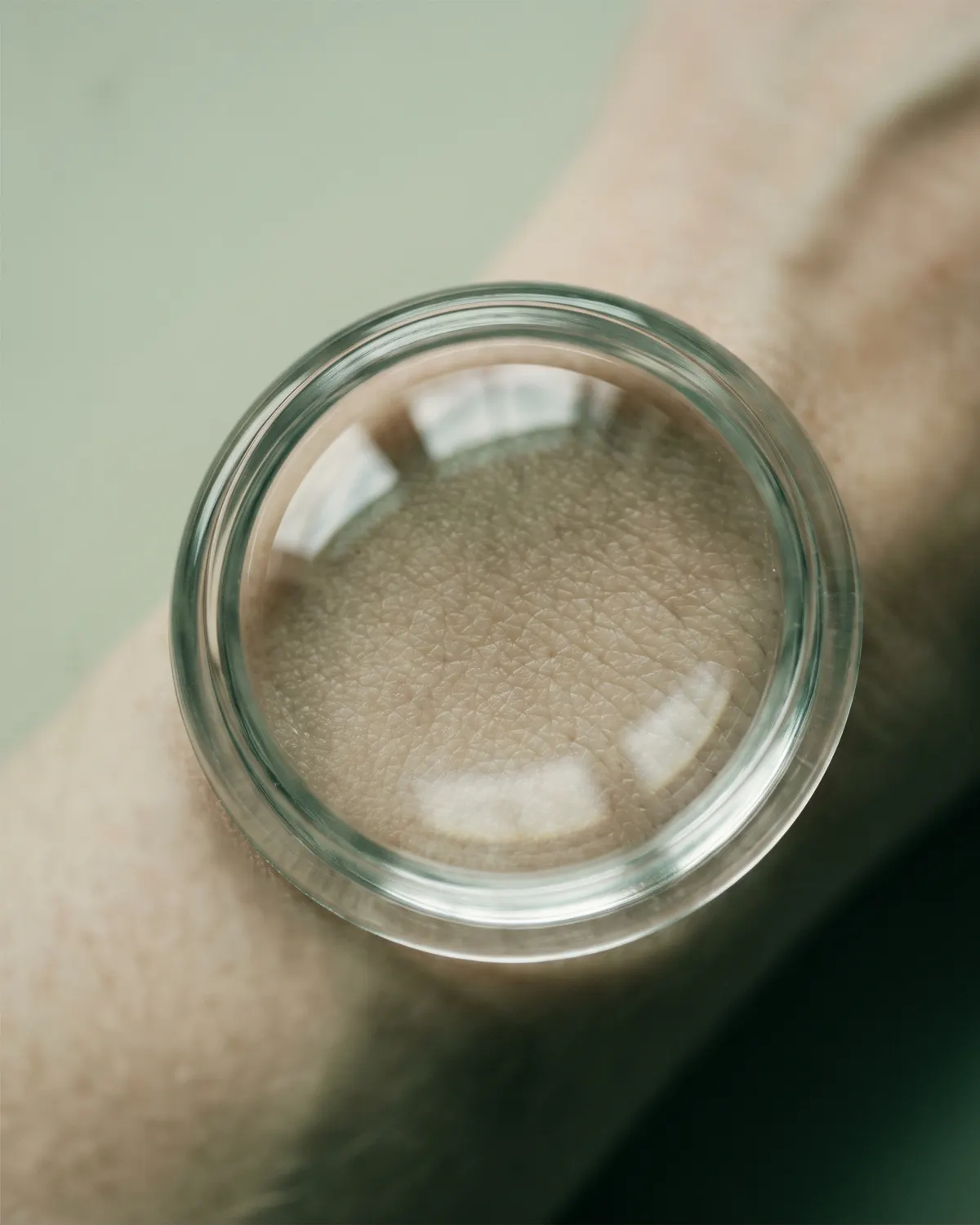 Una lupa de vidrio sobre la piel del antebrazo agranda su textura.